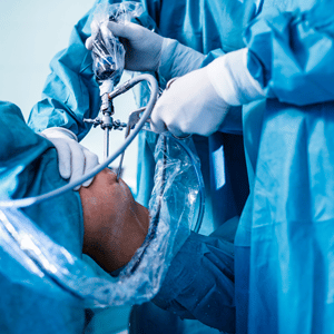 4347 Va Endoscopy Surgical Device Toggle