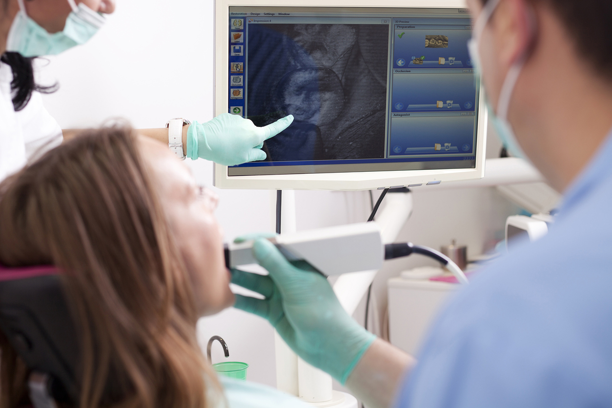 Intra Oral Scanner